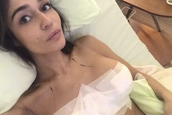 Алена Водонаева после операции